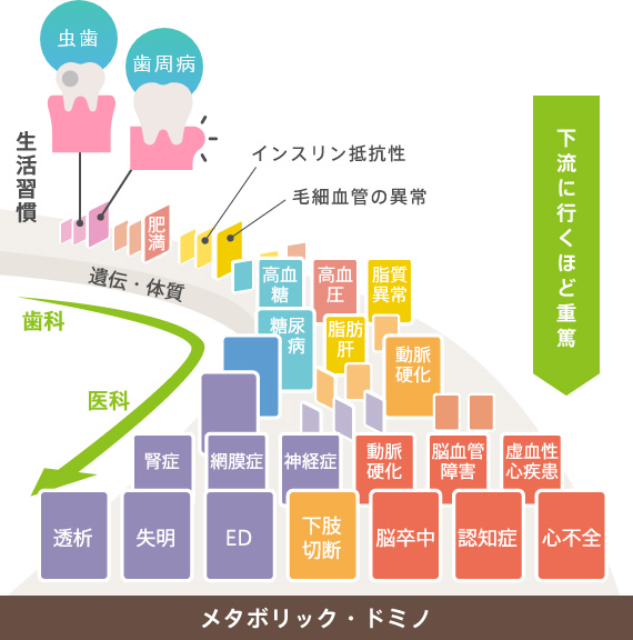 詰め物・被せ物（補綴）治療について